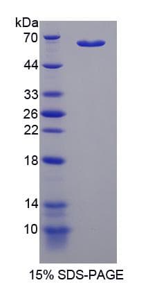 Human MDH1 Protein (Recombinant His-S)