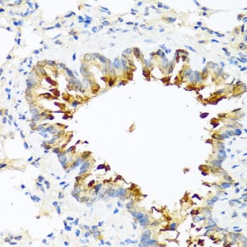 CPB2 / TAFI Antibody