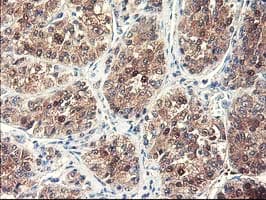 Monoclonal Mouse anti-Human NUBPL Antibody (clone OTI3D11, aa1-250, IHC, WB)