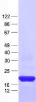 Human TBC1D28 Protein (Recombinant His, N-Terminal)