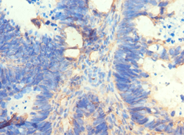 Polyclonal Rabbit anti-Human AMY2A / Pancreatic Amylase Antibody (aa242-511, IHC, WB)