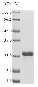 Ciona intestinalis RPS13 / Ribosomal Protein S13 (Recombinant 6His, N-terminus)