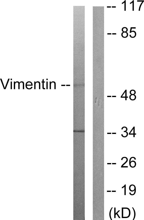 Vimentin Antibody (p83)