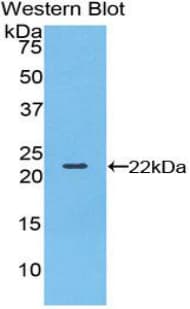 BLMH Antibody (aa27-164)