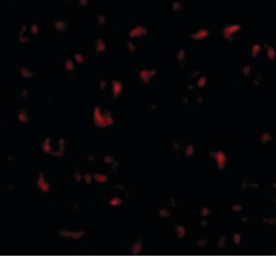 Polyclonal Rabbit anti-Human BMI1 / PCGF4 Antibody (IF, WB)