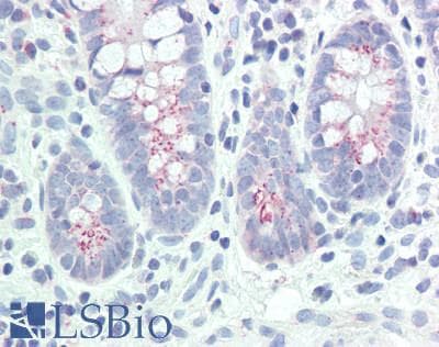IHC-plus™ GOLGA2 / GM130 Antibody (aa952-1002)