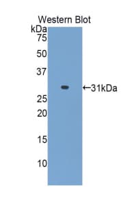 GPT2 / ALT2 Antibody (aa255-507, PE)