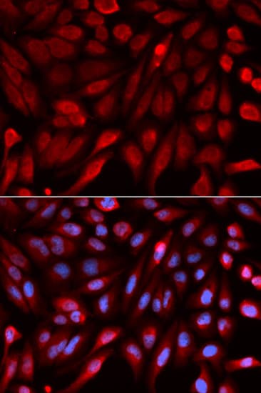 SDCBP / Syntenin Antibody