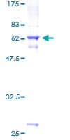 Human SLC25A19 Protein (Recombinant GST)