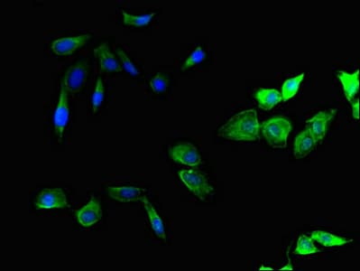 SMURF1 Antibody