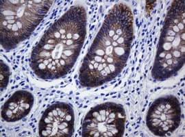 Monoclonal Mouse anti-Human CDH1 / E Cadherin Antibody (clone OTI2F9, IHC, WB)