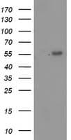TP53 / p53 Antibody (clone OTI1C6)