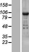 TNRC6B Protein (Over-Expression Lysate Myc-DDK (Flag))