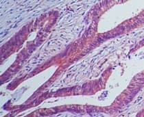 Monoclonal Mouse anti-Human IL23R Antibody (clone 15N6C6, aa288-315, IHC, WB)