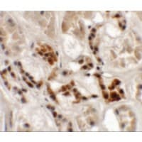 Polyclonal Rabbit anti-Human AP3S1 Antibody (IHC, IF, WB)