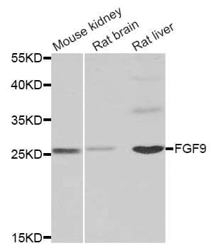 IHC-plus™ Polyclonal Rabbit anti-Human FGF9 Antibody (IHC, IF, WB)