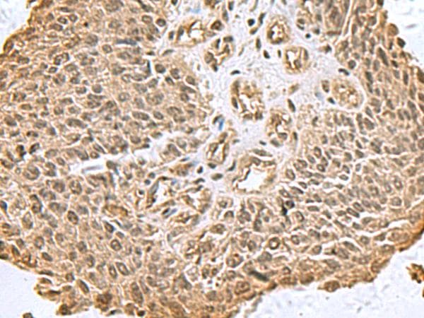 DCTPP1 / XTP3TPA Antibody