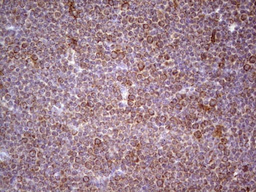 CDKL1 Antibody (aa152-357, clone OTI1D9, Carrier-free)