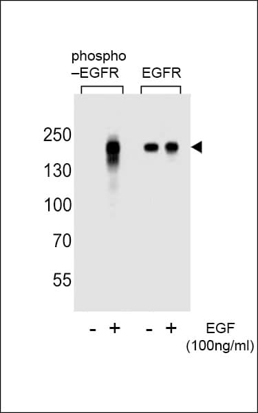 Polyclonal Rabbit anti-Human EGFR Antibody (phospho-Tyr1172, WB)