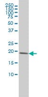 Monoclonal Mouse anti-Human CETN3 Antibody (clone 3E6, WB)
