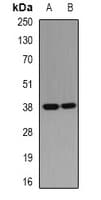 RD / PHYH Antibody