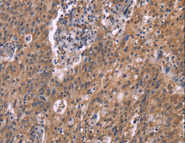 HSD2 / HSD11B2 Antibody