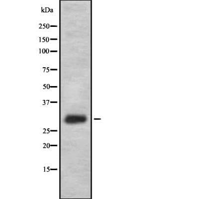 FFAR1 / GPR40 Antibody
