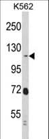 RAIN / RASIP1 Antibody (aa651-678)