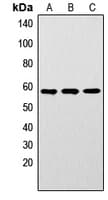 LYN Antibody (phospho-Tyr192)