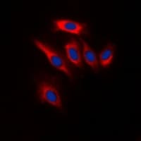 PTEN Antibody (C-Terminus)