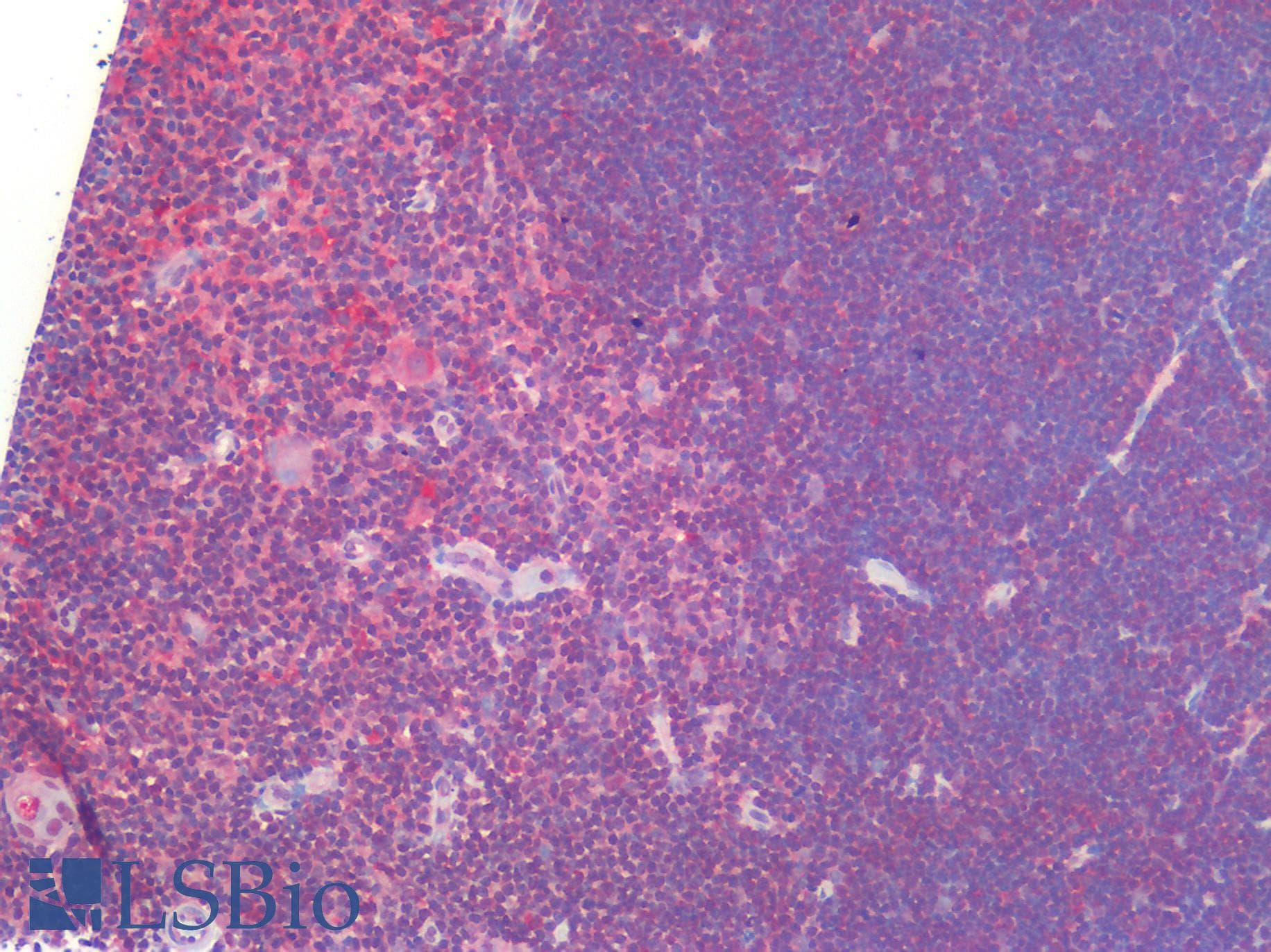 IHC-plus™ Polyclonal Rabbit anti-Human IL23A / IL-23 p19 Antibody (IHC)
