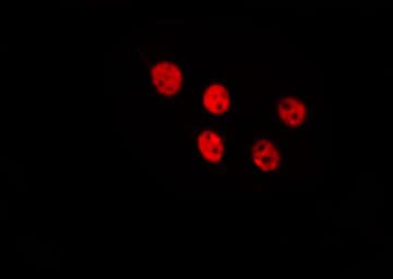 Polyclonal Rabbit anti-Human RFWD3 Antibody (IF, WB)