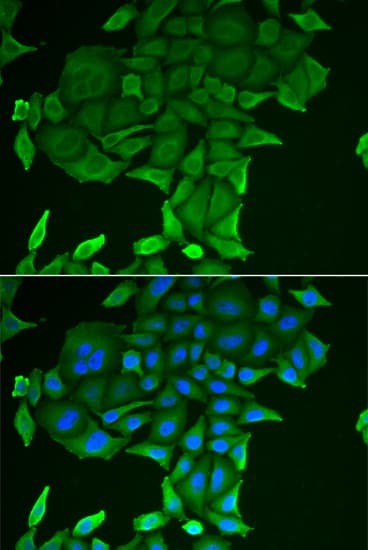 CD84 / SLAMF5 Antibody