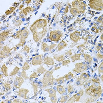 Polyclonal Rabbit anti-Human CML / BCR Antibody (IHC, WB)