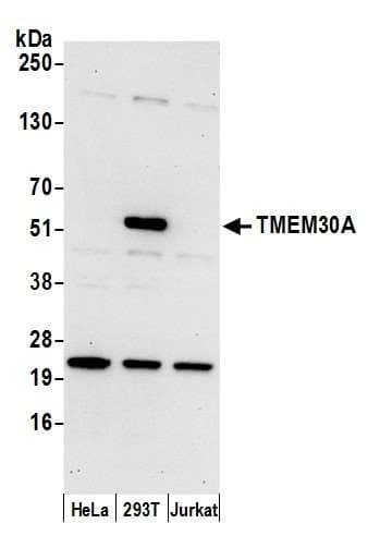 Polyclonal Rabbit anti-Human TMEM30A Antibody (aa311-361, WB)