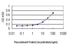 LIMK2 Antibody (clone 2H2-E11)