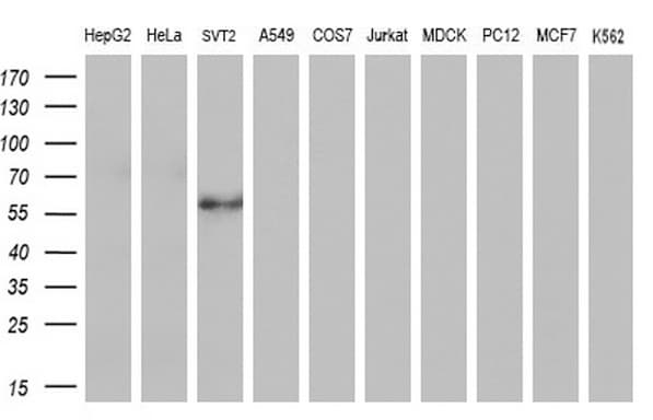 FOXO4 / AFX1 Antibody (aa206-505, clone OTI8A8)