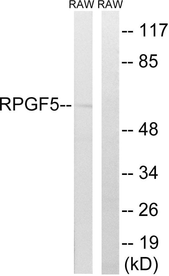 RAPGEF5 / GFR Antibody