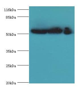 GDI2 Antibody (aa1-445, FITC)