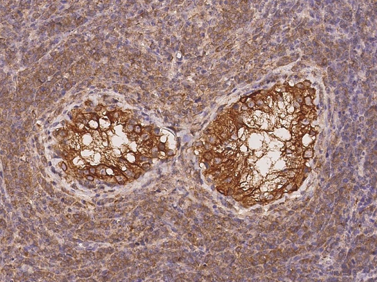 Polyclonal Rabbit anti-Human TUBA1A / Tubulin Alpha 1a Antibody (Preservative Free, IHC, IF, WB)