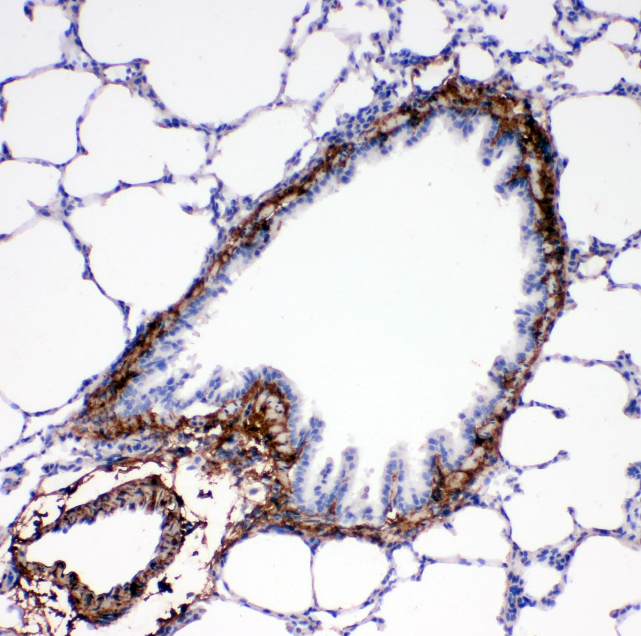 COL1A1 / Collagen I Alpha 1 Antibody (aa1192-1207)