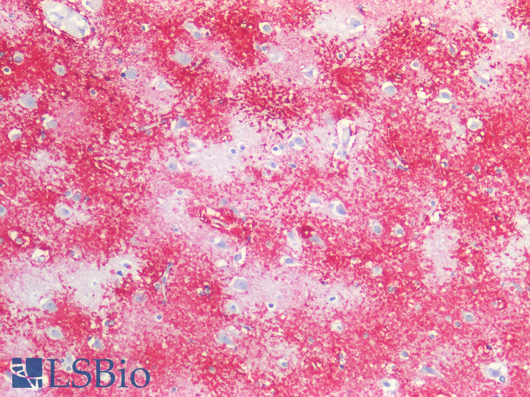 PathPlus™ Polyclonal Rabbit anti-Human APC Antibody (aa2794-2843, IHC, WB)