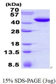 Human MAPKAPK3 Protein (Recombinant His)