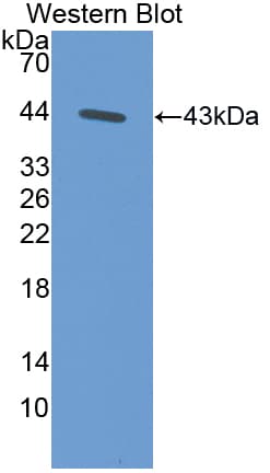 GOT2 Antibody (aa30-430)