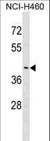 Polyclonal Rabbit anti-Human FEZ2 Antibody (aa1-30, WB)