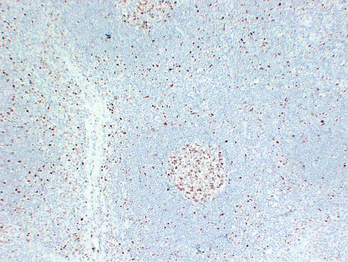 MCM2 Antibody (clone ABT-MCM2)