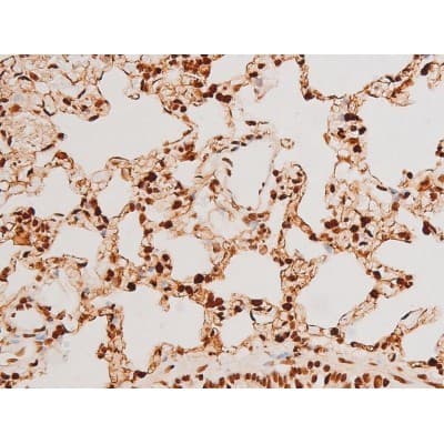 Polyclonal Rabbit anti-Human SYK Antibody (phospho-Tyr348, IHC, IF, WB)