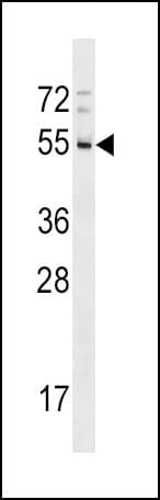 RHD Antibody (aa173-201)