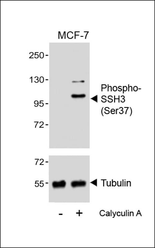 Polyclonal Rabbit anti-Human SSH3 Antibody (phospho-Ser37, WB)