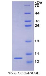 Human PKIG Protein (Recombinant His-T7)